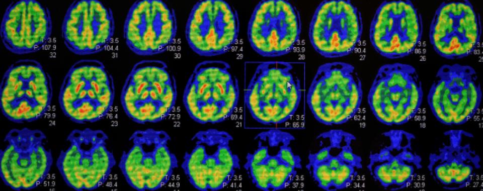 Images d'un scanner d'un cerveau